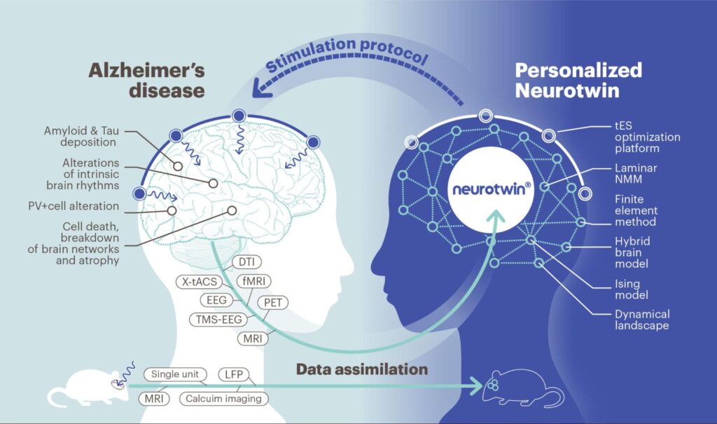 Alzheimer's disease. A Personalized Neurotwin employes model-driven, individualized therapy.