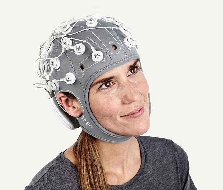 Revolutionizing Epilepsy Management The Rise of Mobile EEG Technology