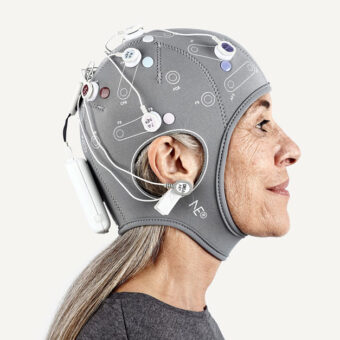 Understanding Traumatic Brain Injuries (TBI): The role of EEG