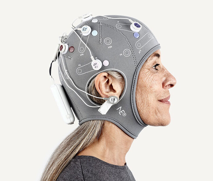 Understanding Traumatic Brain Injuries (TBI): The role of EEG